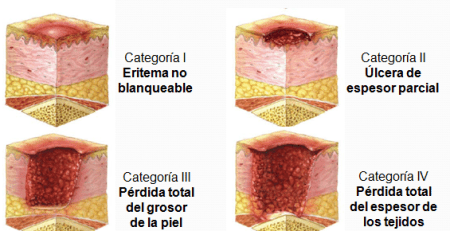 Protecciones antiescaras