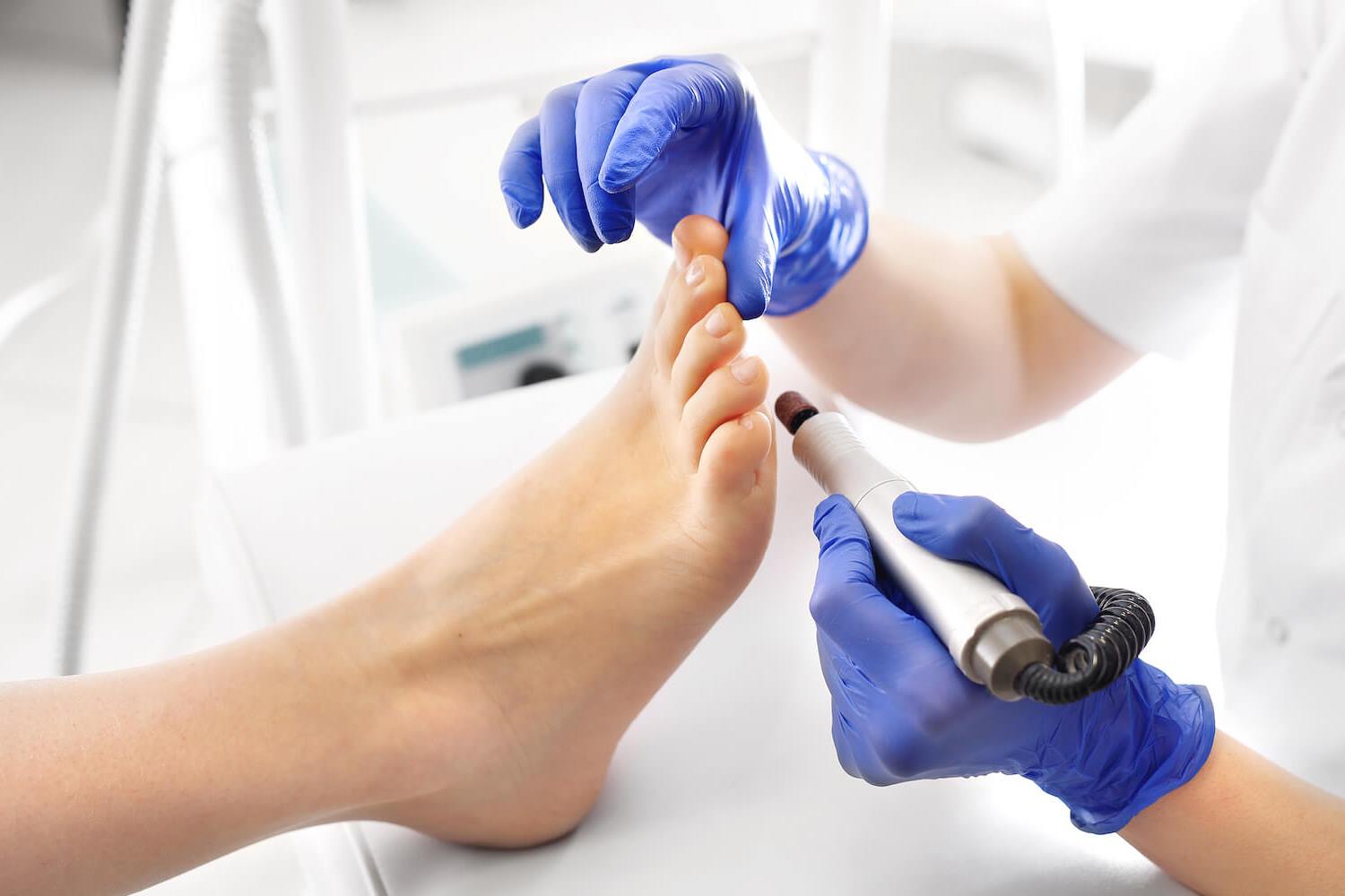 TENGO LOS PIES DOLORIDOS: ¿CÓMO ME PUEDE AYUDAR UN PODÓLOGO?