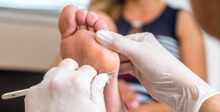 Podólogo en Madrid cerca de mí: ¡encuentra el cuidado ideal para tus pies!