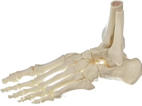Fractura quinto metatarsiano pie